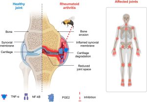 The Powerful Benefits of Bee Venom for Skin Relief: A Natural Option for Psoriasis and Eczema